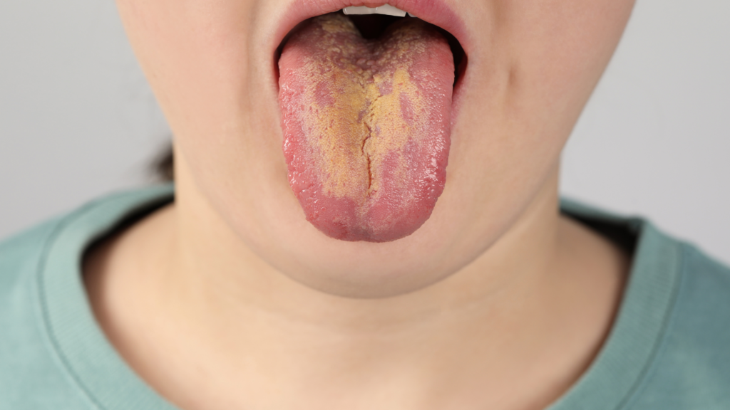 10 common tongue problems and what they indicate about your health