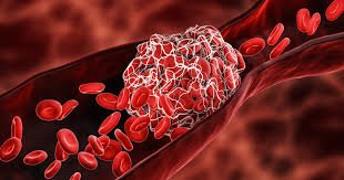 Healthy Blood Vessels