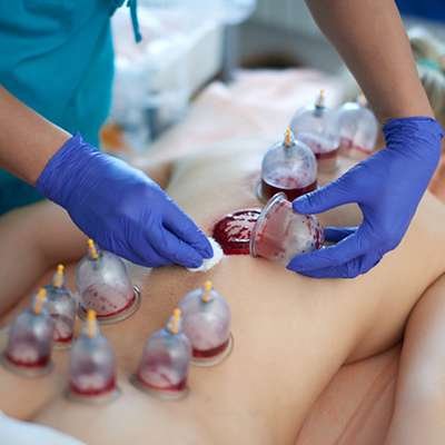 Raktamokshana Ayurvedic therapy at Sandhya Medicity