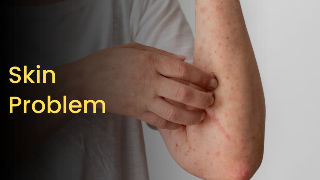 Ayurvedic Treatment of Skin Disease