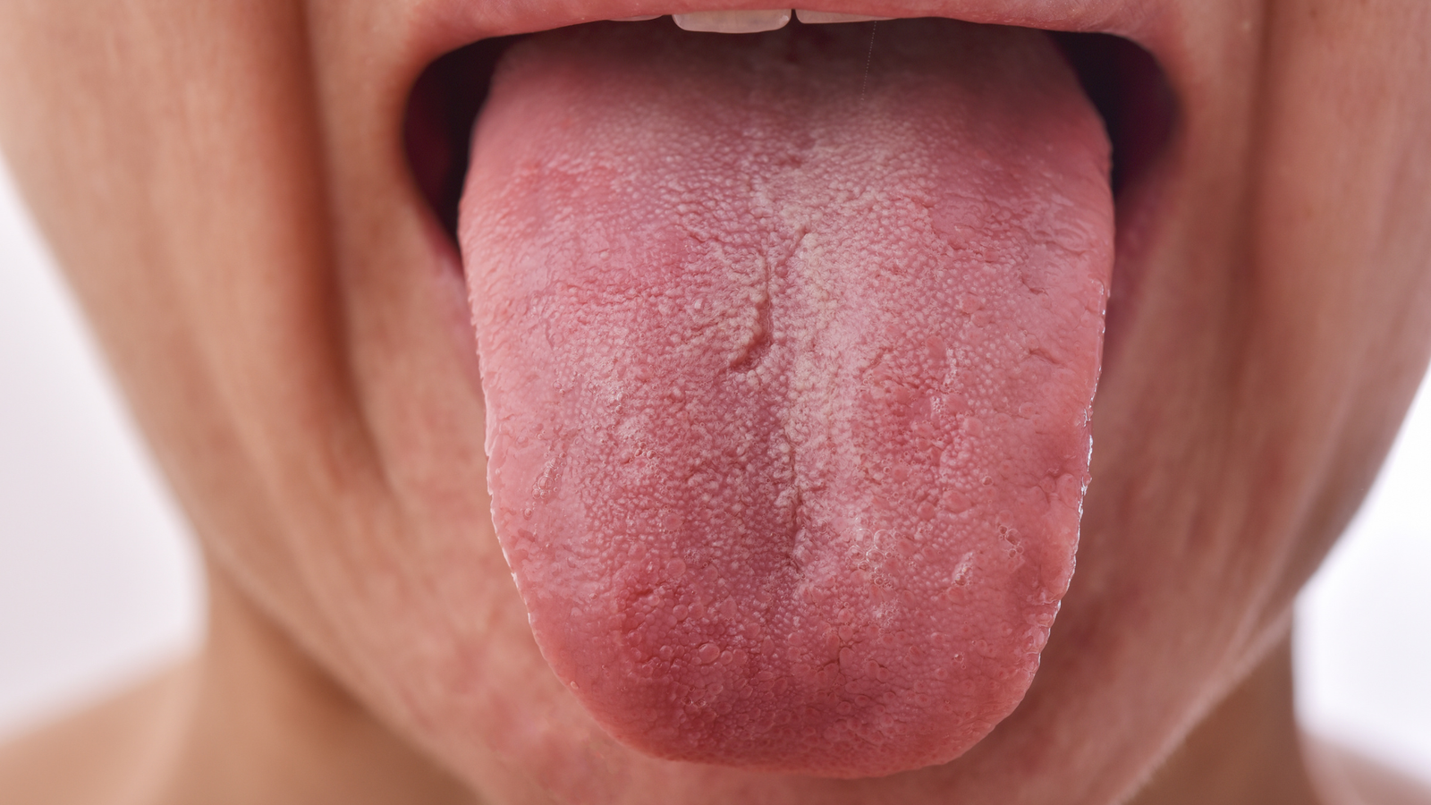 10 common tongue problems and what they indicate about your health