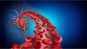 Ayurvedic Remedies to Improve Blood Flow